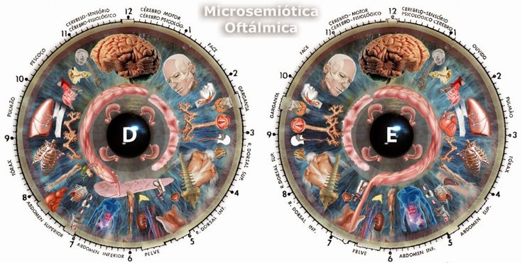 Mapas de Microsemiótica Oftálmica - Íris Direita e Esquerda